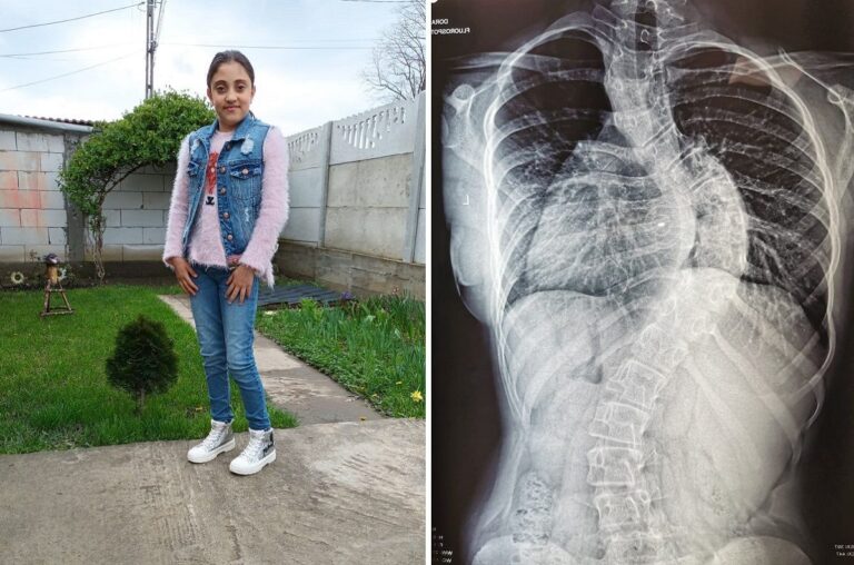 Strigătul de ajutor al unei mame: ,,Coastele îi vor perfora plămânii în lipsa unei intervenţii chirurgicale de urgenţă!”